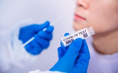 COVID 19 – Test Antigéniques